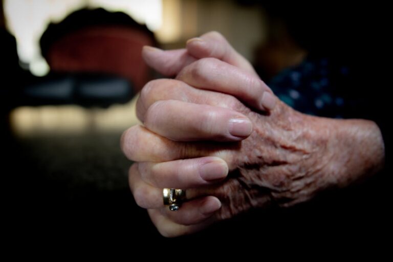 Senile Purpura – Warum blaue Flecken im Alter häufiger werden Senile Purpura – Nahaufnahme älterer Hände mit Altersflecken